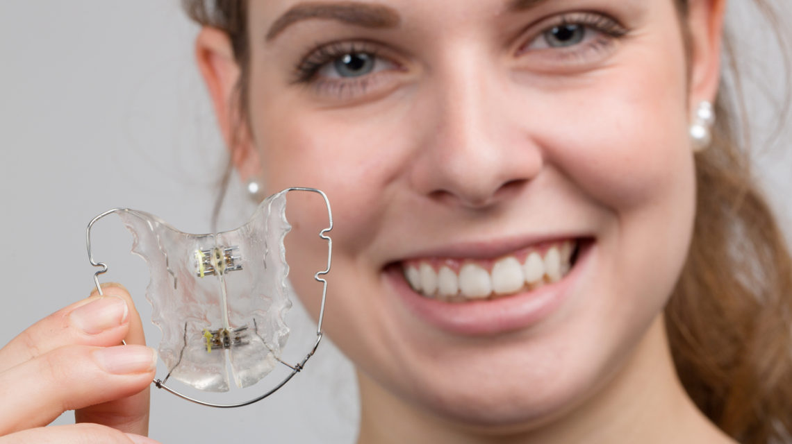 Apparecchi per i denti