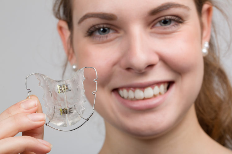 Apparecchi per i denti