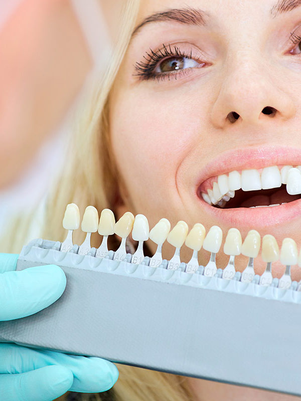 Estetica Dentale