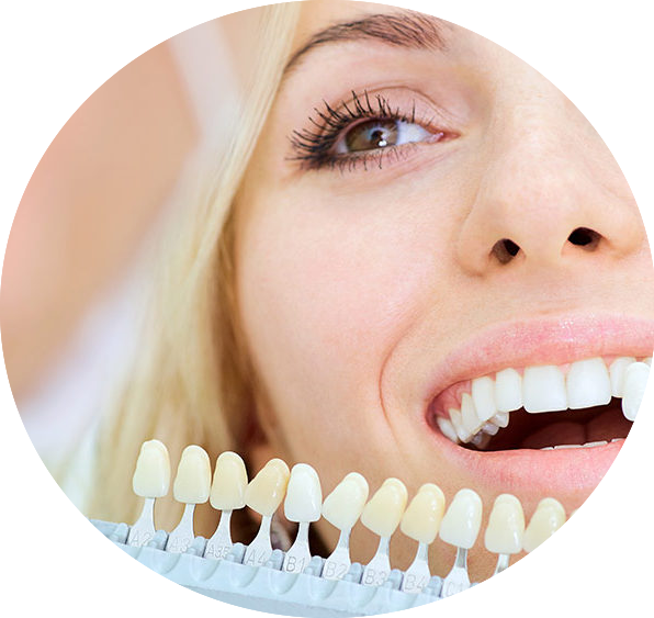 Estetica Dentale