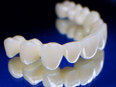 FOTO PROTESI FISSA – Dentaclinic Studi Dentistici