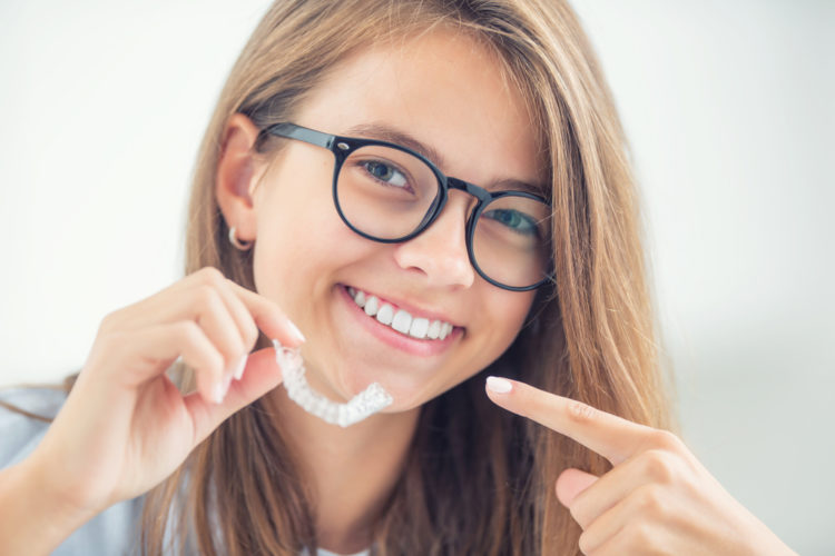 Ortodonzia invisibile Invisalign