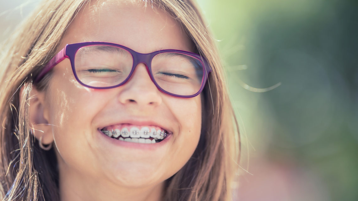 Tipi di apparecchi per denti