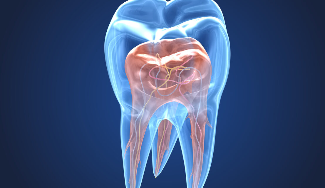 Endodonzia cos’è