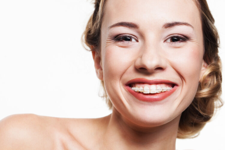 Malocclusione dentale